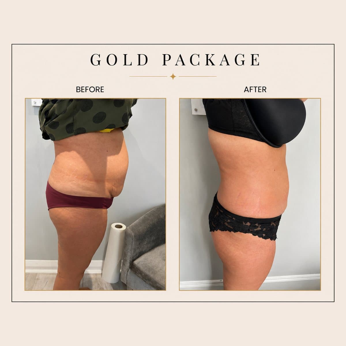 Ultimate Body Transformation before and after at Totally Transformed Newcastle, gold package